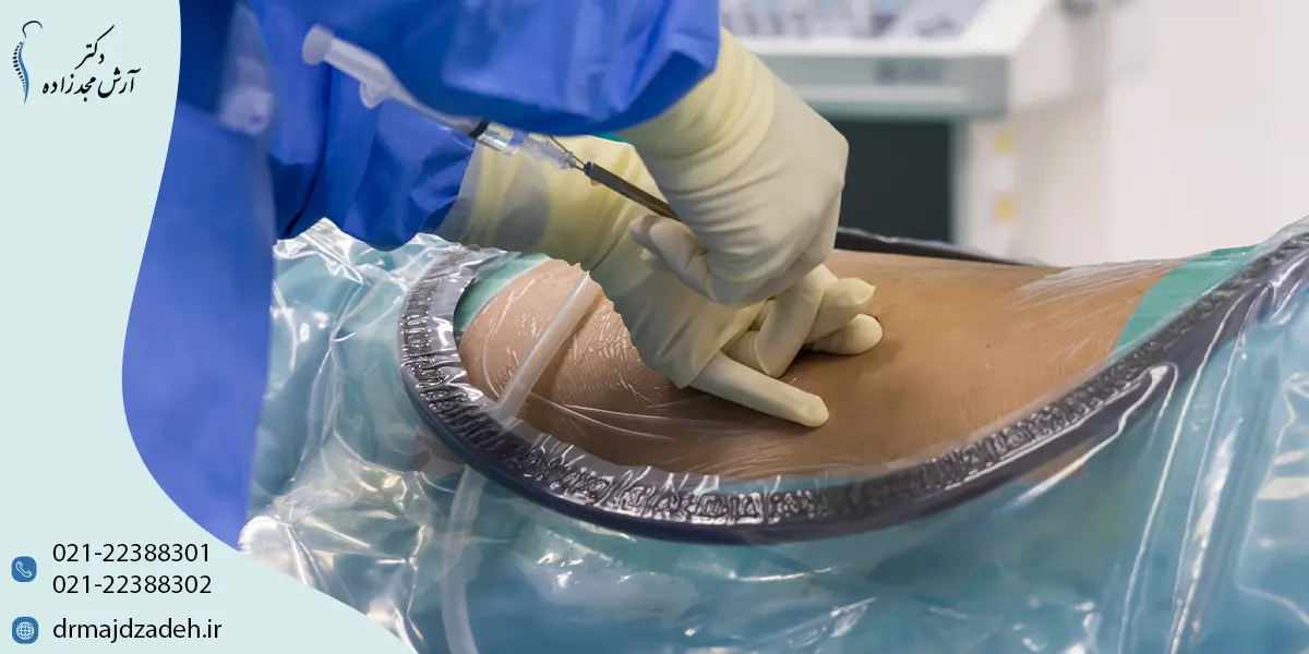 روند پیشرفت و درمان تنگی کانال نخاع