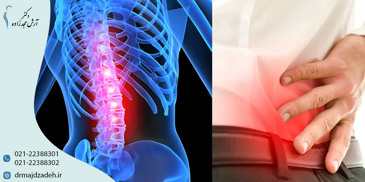 نشانهها و علائم تنگی کانال نخاع چیست؟