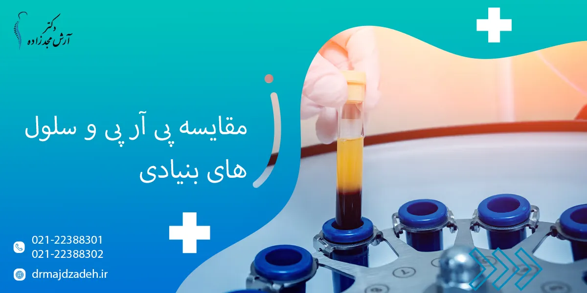 مقایسه پی آر پی و سلول های بنیادی