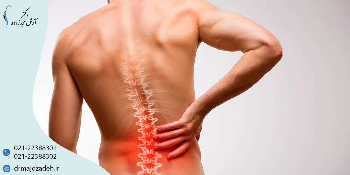 درمان کمر درد