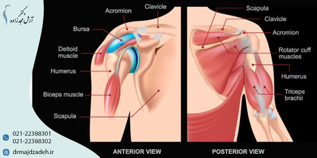 دلایل پارگی تاندون شانه میشود