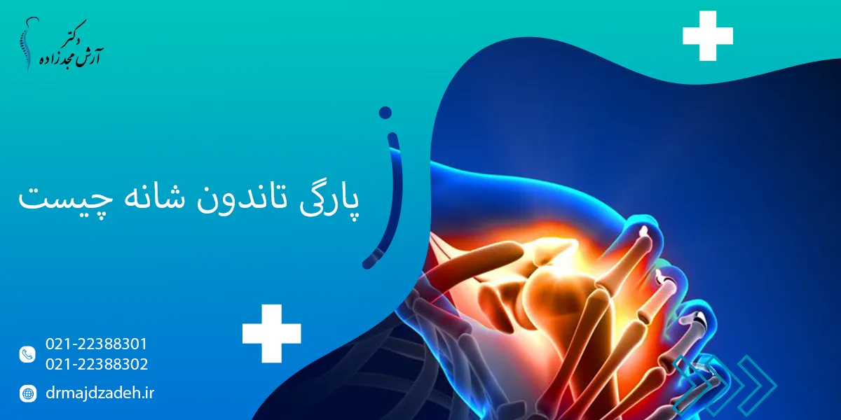پارگی تاندون شانه چیست و روش های درمان آن