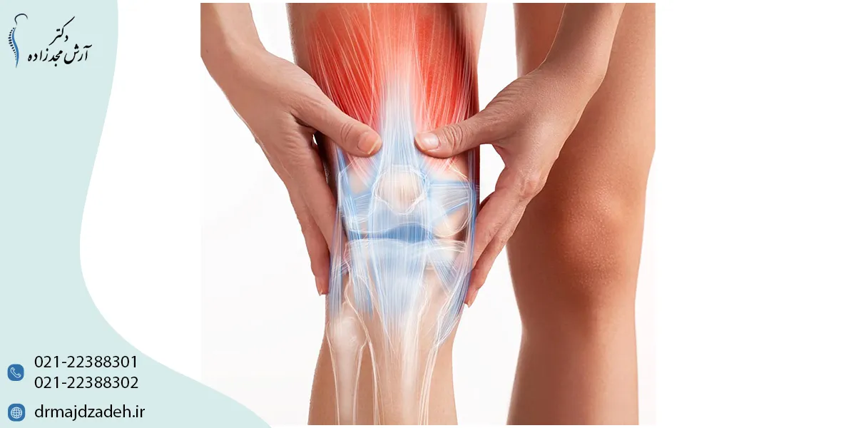 روش‌های درمان آرتروز زانو