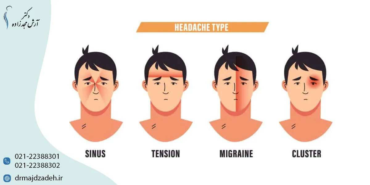 سردرد تنشی یا سردرد میگرنی (Tension Headache) چیست