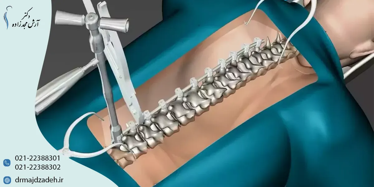 مراقبتهای قبل و بعد از جراحی اسکولیوز