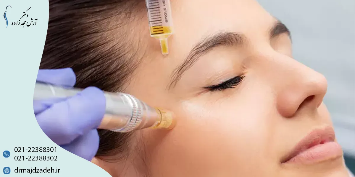 مزایای تزریق سلول بنیادی برای پوست صورت نسبت به روشهای دیگر