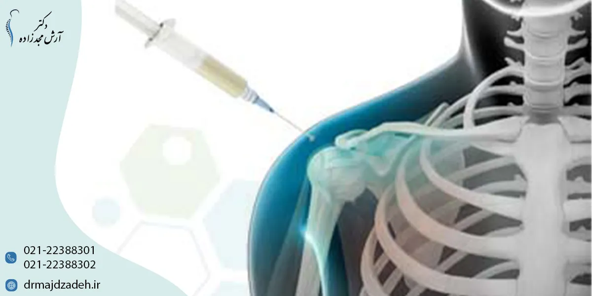 تزریق سلول بنیادی به شانه چیست و چگونه عمل میکند