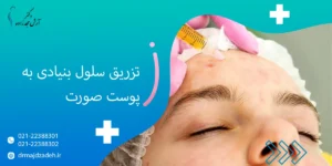 تزریق سلول بنیادی به پوست صورت