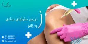 تزریق سلولهای بنیادی به زانو