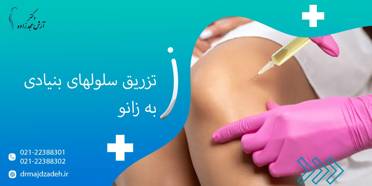 تزریق سلولهای بنیادی به زانو