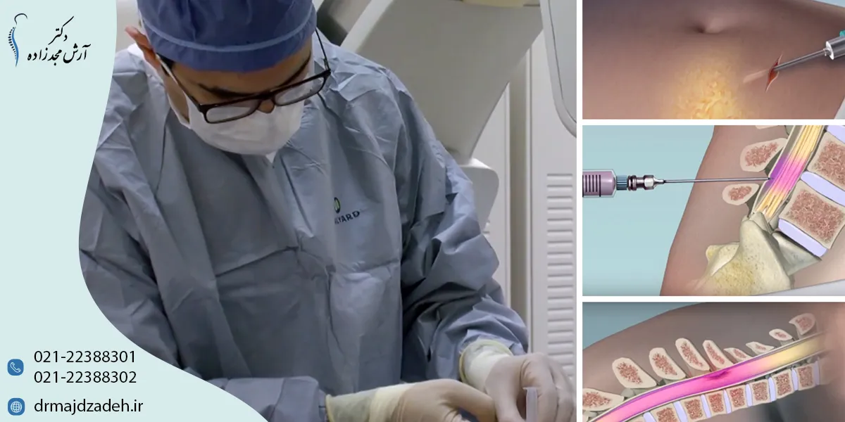 تنگی کانال نخاعی چیست و چرا اتفاق میافتد