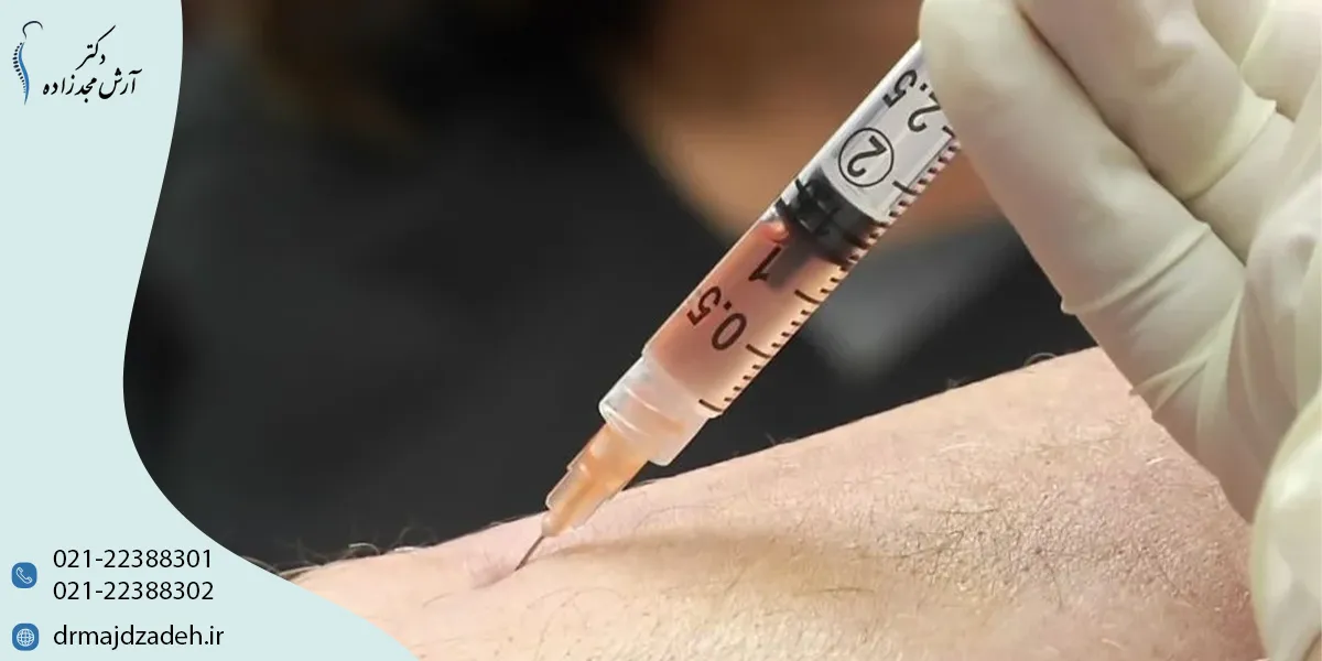 تزریق سلول بنیادی به شانه چیست